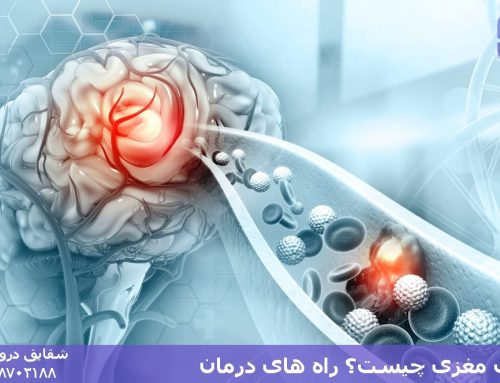 آسیب مغزی چیست؟